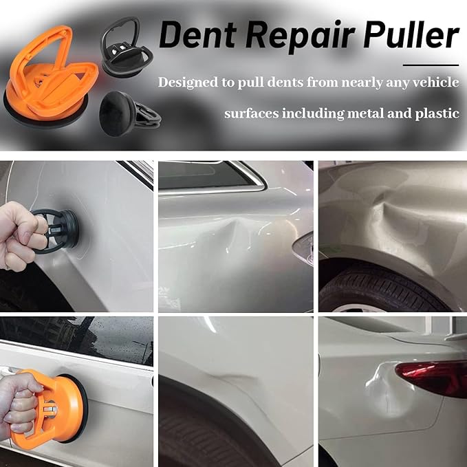 OVEERA Slingvy 2 Suction Dent Puller Kit - Dents Remover - Hias E-commerce